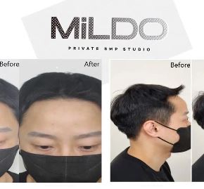 MiLDO_SMP 추천하는 동래두피문신 후기